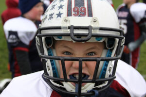 Mouth Guard Care