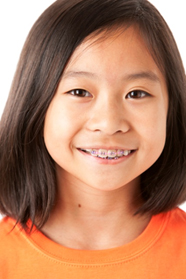 Braces Orthodontist Melissa