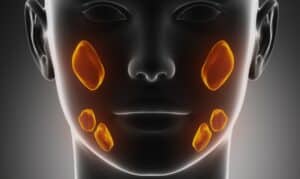 Salivary Gland Stones