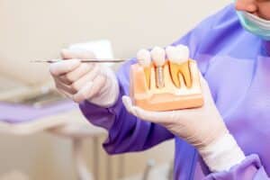 Melissa dental implants