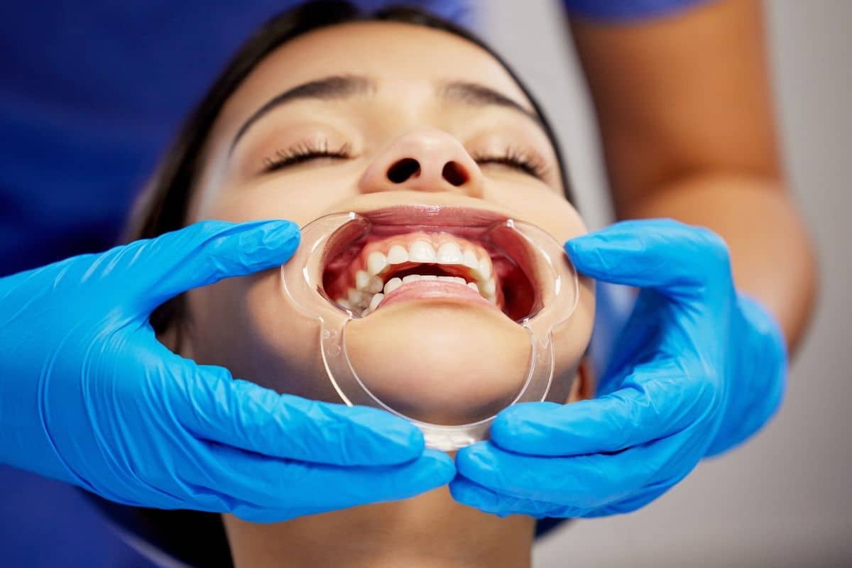 Can Dental Bonding Be Removed? What Melissa Patients Need to Know
