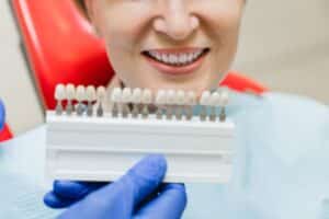 Can Dental Veneers Be Replaced